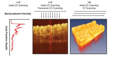 OCT成像系统（医疗）图片2